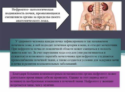 Диета почки белок Нефроптоз - патологическая подвижность почки - online presentation Нефроптоз - патологическая подвижность почки - online presentation Диета почки белок