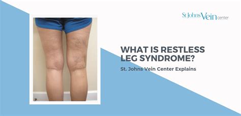Identifying The Link Between Varicose Veins And Restless Legs St