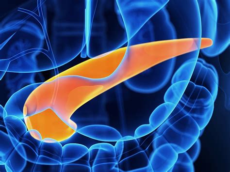 Our vision is to create a world in which all patients with #pancreaticcancer will thrive. Chronic Pancreatitis to Pancreatic Cancer
