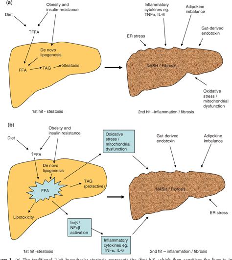 Figure 1 From Pathogenesis Of Non Alcoholic Fatty Liver Disease