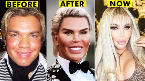 20 People Who Had Extreme Plastic Surgery Go IT