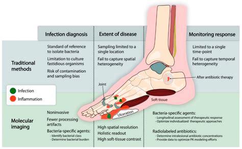 Ijms Free Full Text Molecular Imaging Of Diabetic Foot Infections