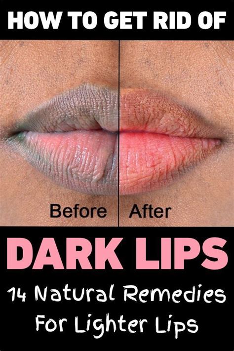 how to get rid of dark lips 14 natural remedies for lighter lips dark lips lips eyeshadow