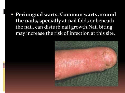 Ppt Viral Infections Powerpoint Presentation Id5736828