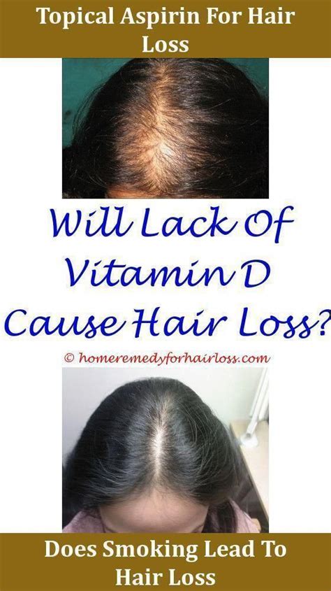 Hair Loss Celiac Disease Cause Hair Loss Can U Stop Hair Loss Hair Loss