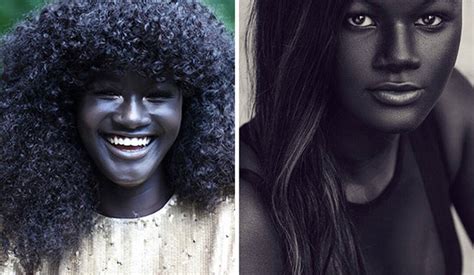 Girl Was Bullied For Her Incredibly Dark Skin Now She Became A Model