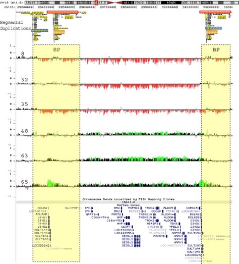 high resolution microarray analysis of 16p11 2 rearrangements download scientific diagram