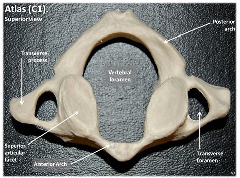 Atlas C1 Vertebra Superior View With Labels Axial Skele Flickr