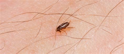 Don't worry though, if there are no apparent signs other than itching, they usually disappear by themselves. Can dog and cat fleas live on humans? | My Pet and I