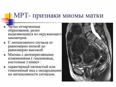 Миома матки мрт или узи что лучше - фото презентация Картинка - Миома матки мрт или узи что лучше - фото презентация