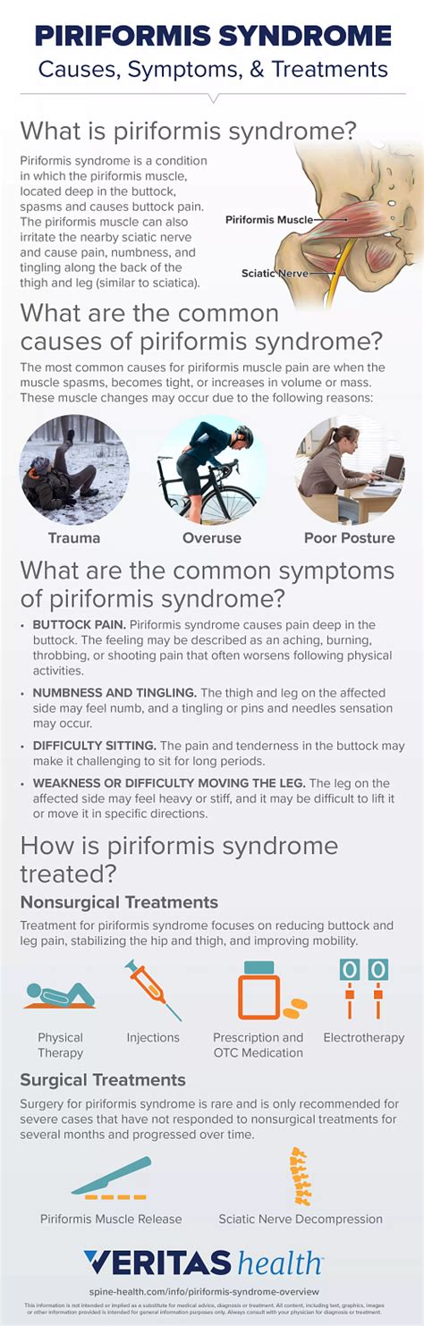 Piriformis Syndrome Overview Infographic Spine Health 万博体育app网址