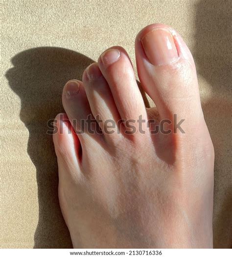 Top View Photo Woman Feet Healthy Stock Photo 2130716336 Shutterstock