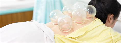 Cupping Therapy Treatments Tcm Tang