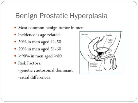 Ppt Neoplasms Of The Prostate Gland Powerpoint Presentation Free Download Id