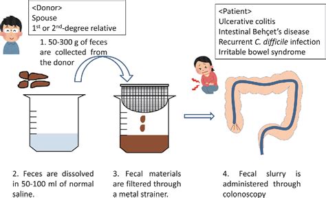 Pdf Fecal Microbiota Transplantation For Gastrointestinal Diseases