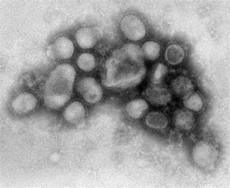 Cdc H1n1 Flu Images Of The H1n1 Influenza Virus