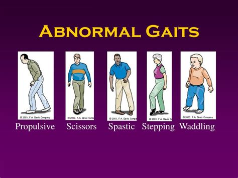 Ppt Assessing The Motor Musculoskeletal System Powerpoint