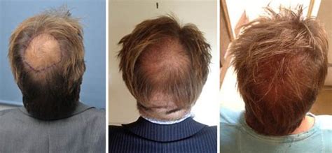 It is not wrong for men to have long hair, but this hairstyle would seem rather unpopular to the vast majority of men. Homes Under The Hammer's Martin Roberts has Wayne Rooney's ...