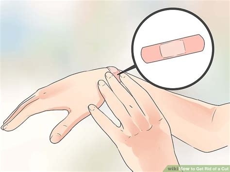 One of their main functions is to prevent moisture loss, so—like hyaluronic acid—they're virtually unmatched as skin care ingredients when it comes to helping get rid of flaky dry skin. How to Get Rid of a Cut (with Pictures) - wikiHow