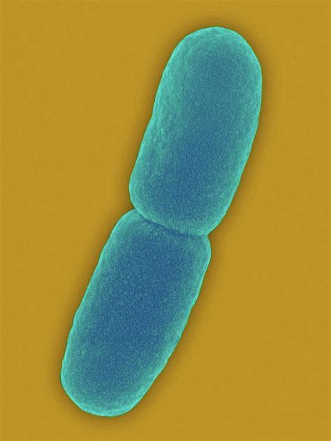 Pseudomonas Aeruginosa Bacteria Photograph By Dennis Kunkel Microscopy