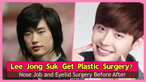 Lee Jong Suk Get Plastic Surgery Nose Job And Eyelid Surgery Before