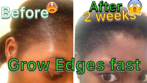 Take your scalp treatment up a notch, by warming your oil prior to massaging it into your scalp. GROW YOUR EDGES FAST IN JUST 2 WEEKS - YouTube | Grow ...