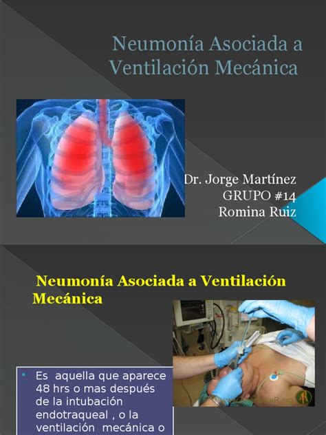 Neumonia Asociada A Ventilacion Mecanica Pdf Neumonía Staphylococcus Aureus