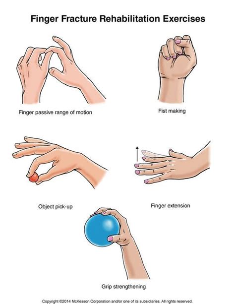 summit medical group finger fracture exercises hand therapy rehabilitation exercises