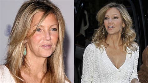 Heather Locklear Plastic Surgery Before And After Botox And Boobs