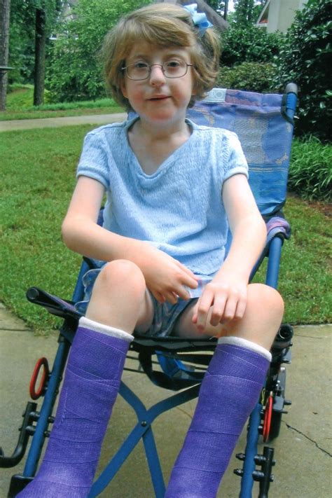 Achilles tendon repair surgery is a type of surgery to fix a damaged achilles tendon. Imperfectly Possible: Amanda's First Surgery - Bilateral ...