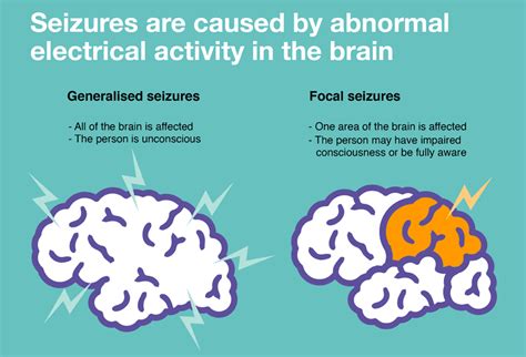 types of seizures and their symptoms south valley neurology neurologists