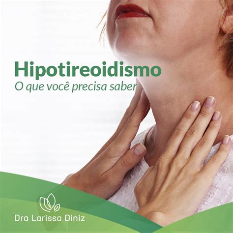 Hipotireoidismo Causas Sintomas E Tratamento Dr Arthu Vrogue Co