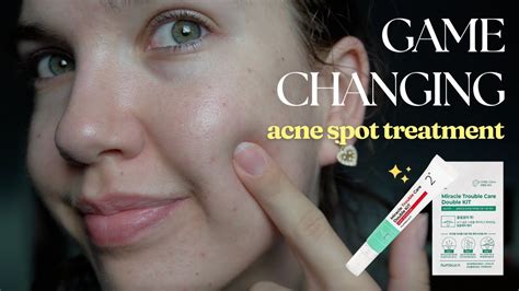 Let's Talk About Game Changing Skincare for Acne-Prone Skin - YouTube