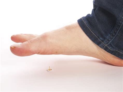 The Difference Between Pins And Needles And Peripheral Neuropathy Arrowhead Health Centers