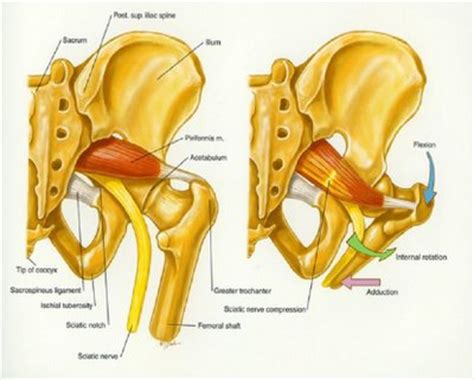I hope to report back with closer to 100 resolution of the back pain in the morning problem after trying the quadratus lumborum stretch done with a diagram showing the location of perfect spot no 12 in the superomedial edge of the no lower back muscle names lower back pain location chart back. Sacrum Gluteus Dance Links - Yoga Bloom