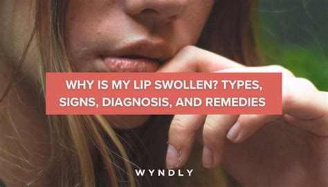 Swollen Lips Causes Symptoms And Treatment 2023 And Wyndly