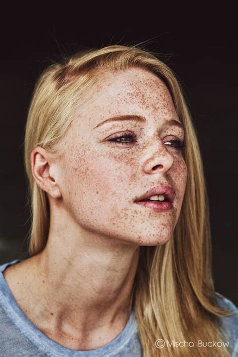 40 Fascinating Pictures Of People With Freckles Greenorc