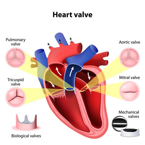Mechanical Heart Valves Heart Surgery Information