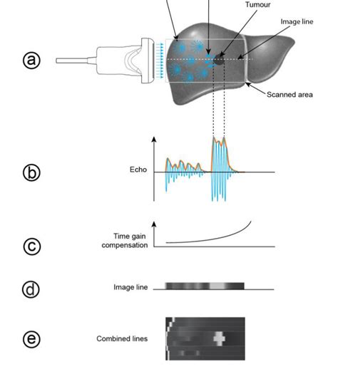 Ch01 Physical Principles Of Medical Ultrasound Efsumb