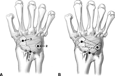 Dorsal Hand Anatomy