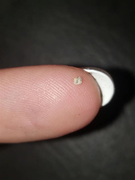1st Post Pulled This Out Of My Gums Residual Bone Fragment From