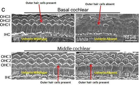Filebasal Cochlear Outer Hair Cells Embryology