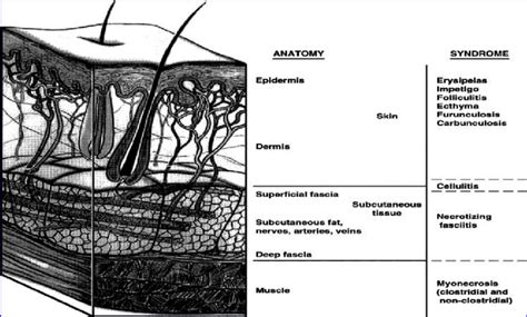 Anatomy Of Skin And Soft Tissue Structures And Layers Commonly Involved