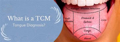 Understanding Your Health With Tcm Tongue Diagnosis Ohco