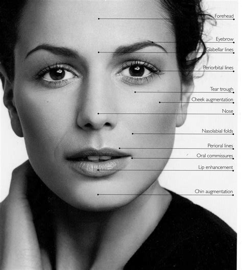Dermal Fillers Face Map | Organic face mask, Organic face products