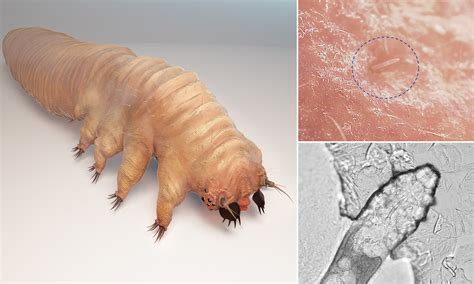 Microscopic Bugs On Body