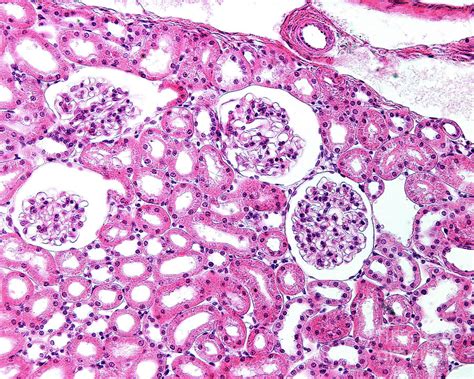 Medullary Rays In Kidney Cortex Photograph By Jose Calvo Science