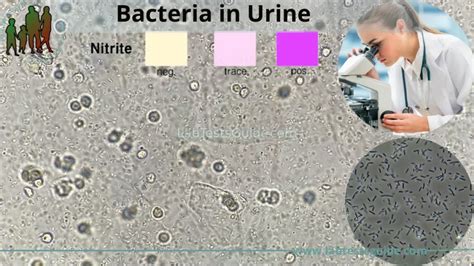 Bacteria In Urine Lab Tests Guide