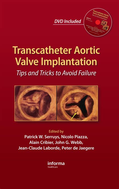 Solution Transcatheter Aortic Valve Implantation Tips And Tricks