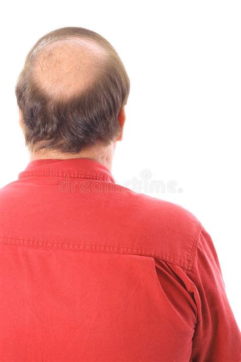 mans bald head isolated on white aff bald mans head white isolated ad bald head